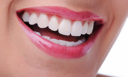 mảng bám răng, loại bỏ mảng bám răng, dầu dừa giúp đánh bật mảng bám răng