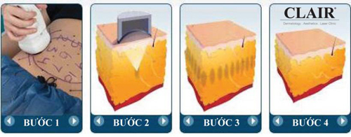 Giảm cân thông minh, Giảm cân, Giảm cân hiệu quả