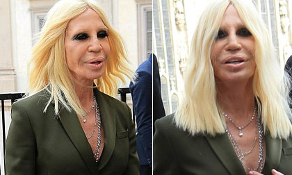 Donatella Versace,thảm họa thẩm mỹ Donatella Versace, Donatella Versace  lộ mặt xấu