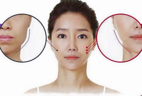 Tạo cằm V-line, Kem massage Anna Chu, Tạo cằm V-Line bằng kem