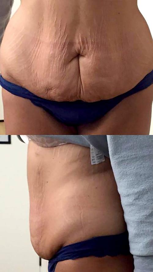 giảm béo, cô gái giảm béo, giảm béo vì mua 2 chỗ trên máy bay, giảm béo thành công