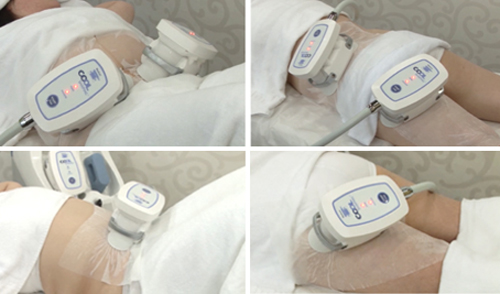 solar-spa-65-5-ngoisao 0 Giảm béo, Công nghệ giảm béo, Công nghệ điều trị hủy mỡ hoàn toàn, Solar Spa