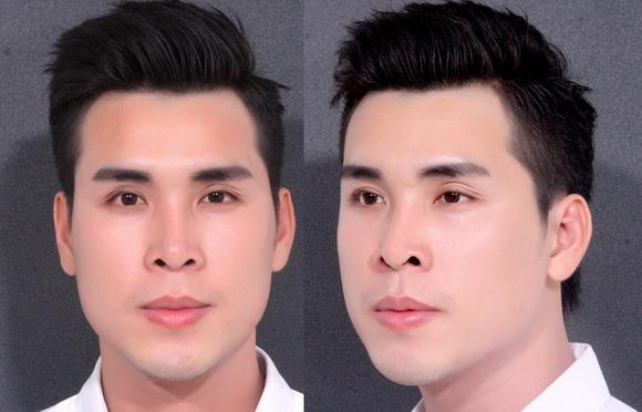 hoang-phi-kha-125-1-ngoisao 6 Hoàng Phi Kha, Phẫu thuật sửa mũi, Bệnh viện thẩm mỹ Hiệp Lợi