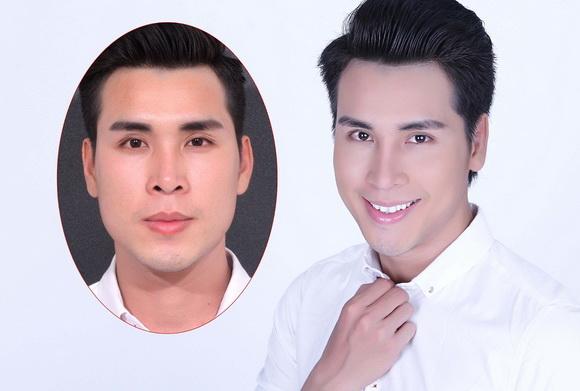 hoang-phi-kha-125-2-ngoisao 5 Hoàng Phi Kha, Phẫu thuật sửa mũi, Bệnh viện thẩm mỹ Hiệp Lợi