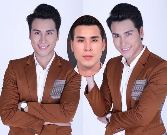 hoang-phi-kha-125-4-ngoisao 3 Hoàng Phi Kha, Phẫu thuật sửa mũi, Bệnh viện thẩm mỹ Hiệp Lợi