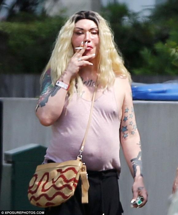 Pete Burns, ca sĩ nghiện dao kéo, phẫu thuật thẩm mỹ, sao phẫu thuật thẩm mỹ,