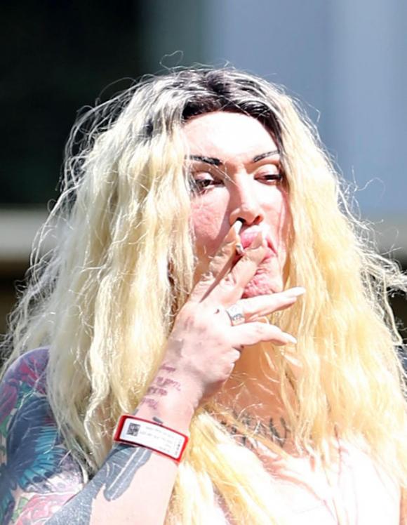 Pete Burns, ca sĩ nghiện dao kéo, phẫu thuật thẩm mỹ, sao phẫu thuật thẩm mỹ,