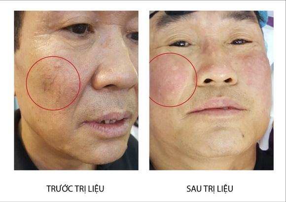 H&A Group, Triển lãm Quốc tế Chuyên ngành Y dược 2016, Thiết bị thẩm mỹ