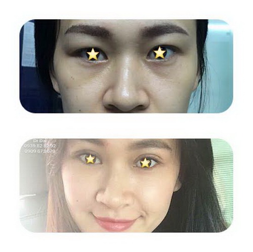 Bác sĩ Trịnh Quang Đại, Phẫu thuật thẩm mỹ, Bệnh viện đa khoa Sài Gòn