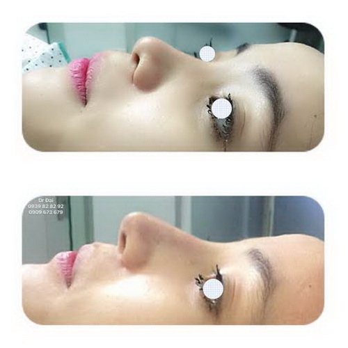 Bác sĩ Trịnh Quang Đại, Phẫu thuật thẩm mỹ, Bệnh viện đa khoa Sài Gòn