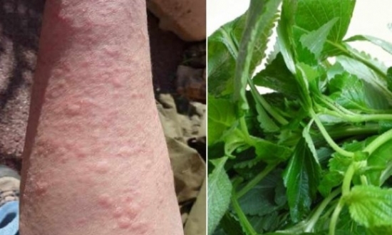 mề đay, rau kinh giới, chữa mẩn ngứa, chữa bệnh ngứa
