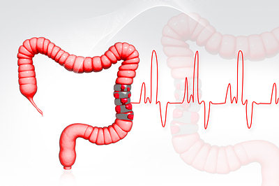 ngồi lâu, tác dụng của ngồi lâu, ngồi lâu gây tử vong, ít vận động