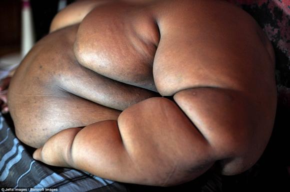  béo nhất thế giới , cậu bé béo nhất thế giới nặng 192kg , bé 10 tuổi nặng 192kg, kỳ quặc
