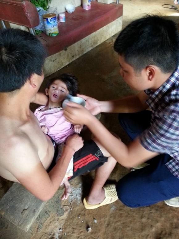 em bé, em bé bị đói, em bé gầy, em bé bị đói ở Lào Cai, em bé thiếu ăn, trẻ em nghèo, hình ảnh xúc động