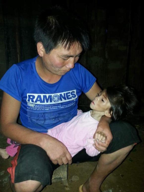 em bé, em bé bị đói, em bé gầy, em bé bị đói ở Lào Cai, em bé thiếu ăn, trẻ em nghèo, hình ảnh xúc động