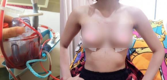 Hotgirl , Hotgirl Thái Lan, nâng cấp vòng một, phẫu thuật thẩm mỹ, bơm ngực