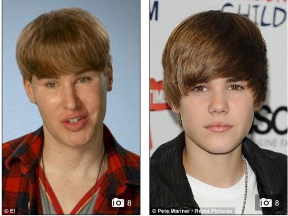 Justin Bieber, ca sĩ Justin Bieber, phẫu thuật giống Justin Bieber, ngôi sao, sao Hollywood