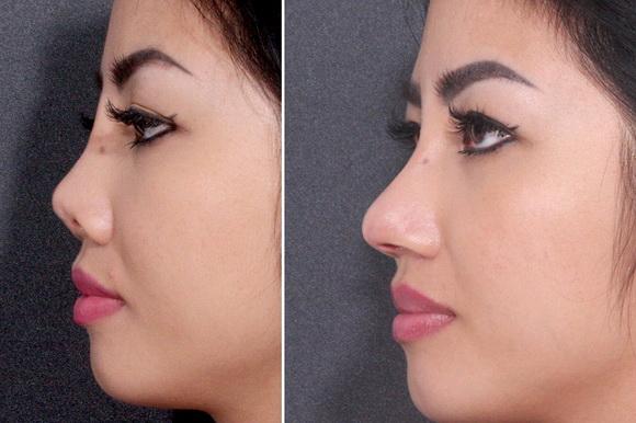 Bệnh viện Thẩm mỹ Hiệp Lợi, Thẩm mỹ Hiệp Lợi, Bác sĩ Hàn Quốc phẫu thuật thẩm mỹ