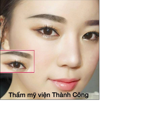tham-my-vien-thanh-cong-58-1-ngoisao 7 Thẩm mỹ viện Thành Công, Phun lông mày, Phun tán bột lông mày