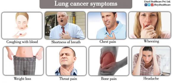 ung thư phổi, ung thu phoi, nguyên nhân ung thư phổi, triệu chứng ung thư phổi