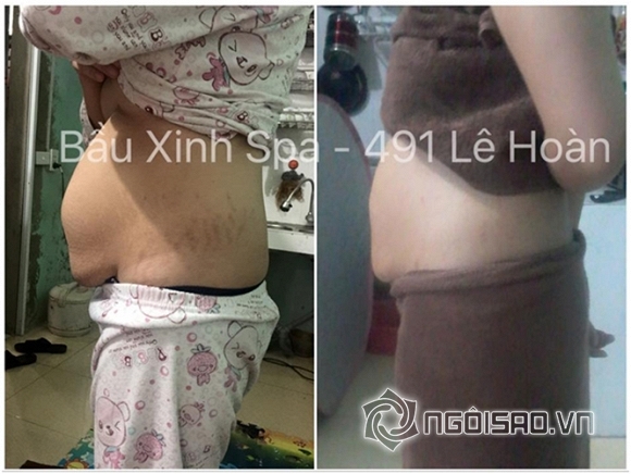 Bầu Xinh - Việt Care, spa, làm đẹp, chăm sóc da, massage Bầu & Chăm sóc sau sinh, Bầu Xinh Spa