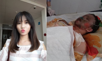 Nguyễn Thị Thanh Hằng, Thiếu nữ sinh đẹp bị bỏng, Nữ cử nhân xinh đẹp bị bỏng toàn thân
