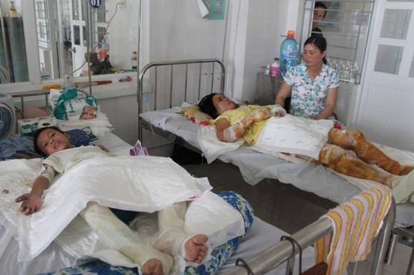 Cô gái bị bỏng toàn thân mặt biến dạng, Cô gái xinh đẹp bị bỏng toàn thân, Bỏng toàn thân sau tai nạn