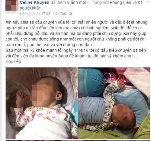 Bác sĩ tắc trách, Bé bị bại não do bác sĩ tắc trách khi đỡ đẻ, Bệnh viện Sa Pa