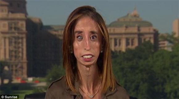 Người phụ nữ xấu xí nhất thế giới,  Lizzie Velasquez, Cô gái xấu xí nhất thế giới