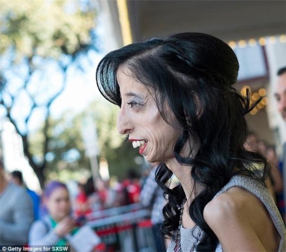 Người phụ nữ xấu xí nhất thế giới,  Lizzie Velasquez, Cô gái xấu xí nhất thế giới