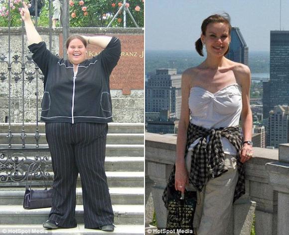 Giảm cân quá đà, Biêng ăn, Cô gái giảm từ 187kg xuống còn 49kg