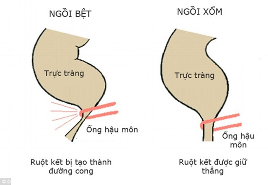 ngồi vệ sinh đúng tư thế, Ngồi vệ sinh sai tư thế, Đi vệ sinh sai cách