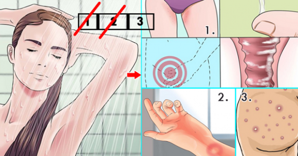 tắm rửa, không tắm 2 ngày, không tắm rửa, viêm da