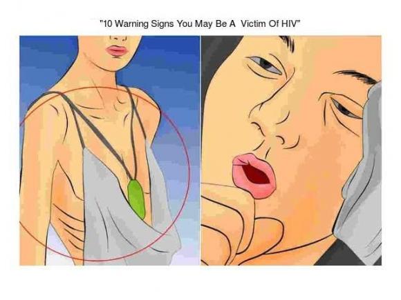 HIV, HIV nhiễm giai đoạn đầu, dấu hiệu HIV, dấu hiệu nhiễm HIV giai đoạn đầu, dấu hiệu nhiễm HIV, dau hieu nhiem HIV