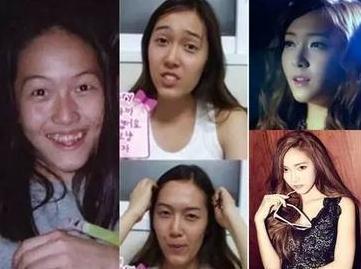 sao Hàn,đệ nhất mỹ nhân dao kéo,sao nữ Hàn thẩm mỹ,Jessica,Nana,Lee Da Hae,Soyeon,Boram,Im Na Young,Park Min Young,Yoon Hyun Suk