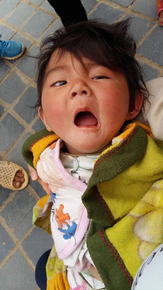 bé gái Lào Cai 14 tháng tuổi, Bé gái lào cai bị suy dinh dưỡng, Bé gái Yến Nhi, Thào Thị Yến Nhi