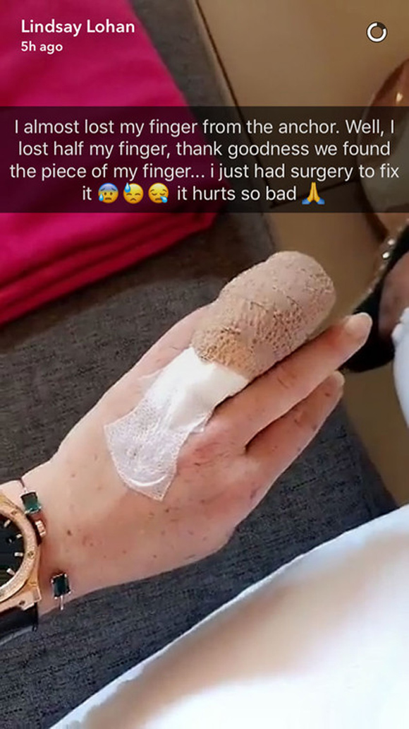 Lindsay Lohan, Lindsay Lohan bị tai nạn, Lindsay Lohan bị đứt lìa ngón tay