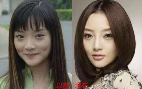 sao Hoa ngữ,sao Hàn,sao châu Á,bằng chứng thẩm mỹ của sao châu Á,sao châu Á thẩm mỹ mũi