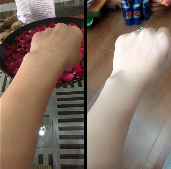 dzung-spa-1210-3-ngoisao 0 Dzung Spa, Viện thẩm mỹ Dzung Spa, công nghệ phun trắng Italy