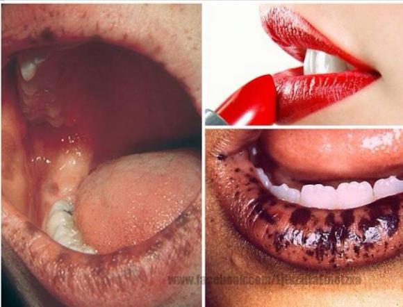 son môi, tác hại của son môi, son môi có chứa chì, son môi chứa các kim loại, từ bỏ thói quen đánh son