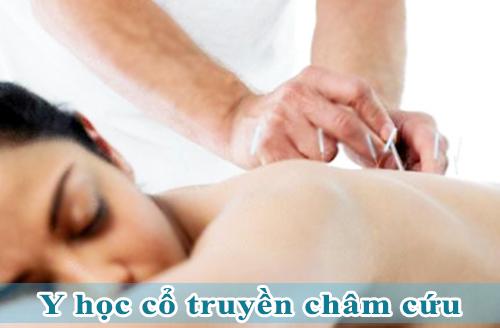y-hoc-co-truyen-cham-cuu-ngoisao.vn-w500-h328 0 Đông Y, Y học cổ truyền, Trung cấp Đông Y