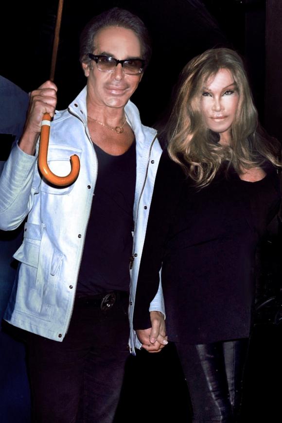 sao ngoại, thảm họa thẩm mỹ, Jocelyn Wildenstein,  thảm họa thẩm mỹ hành hưng bạn trai