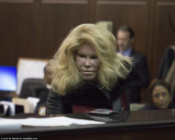 sao ngoại, thảm họa thẩm mỹ, Jocelyn Wildenstein,  thảm họa thẩm mỹ hành hưng bạn trai