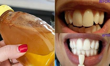 trắng răng, răng ố vàng, chăm sóc răng miệng