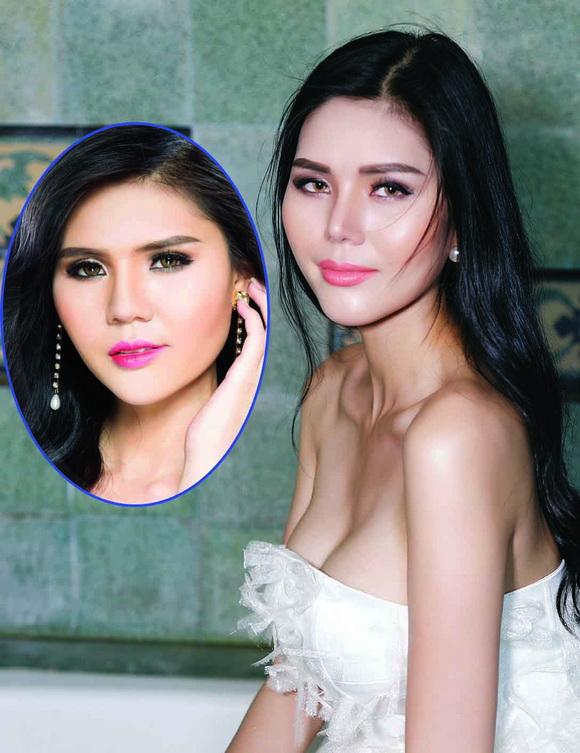 Á hậu Kim Nguyên, Kim Nguyên, Bệnh viện Thẩm mỹ Hiệp Lợi