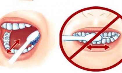 răng miệng, vệ sinh răng miêng, vệ sinh răng miệng không đúng cách