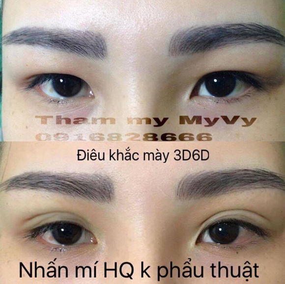 tham-my-myvy-171-4-ngoisao.vn-w580-h578 10 Thẩm mỹ MyVy , Phun xăm thẩm mỹ, Phun mày, Phun môi