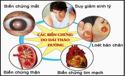 tiểu đường, điều trị bệnh tiểu đường, thực phẩm cho bệnh nhân tiểu đường