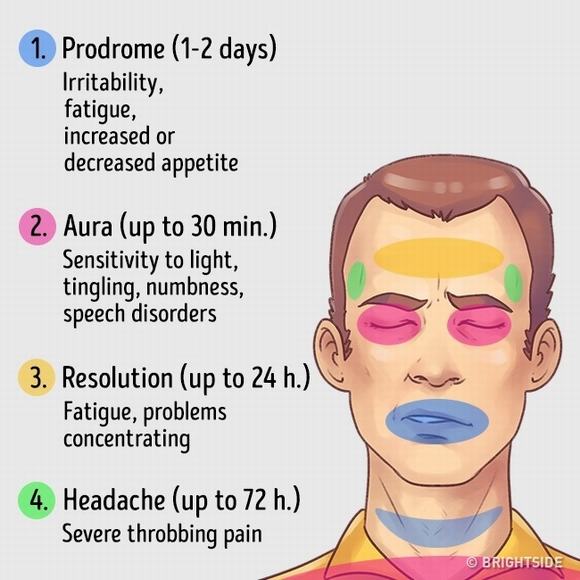 đau đầu, các loại đau đầu, chữa đau đầu