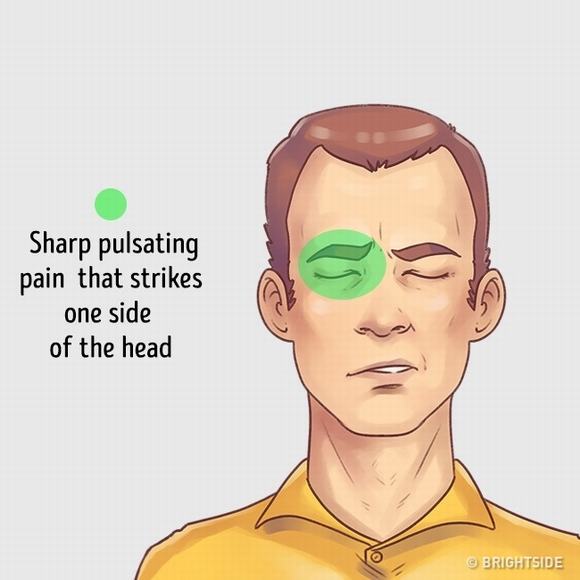 đau đầu, các loại đau đầu, chữa đau đầu